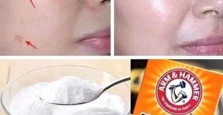 4 Ways to Erase Age Spots with Baking Soda for Younger, More Even Skin