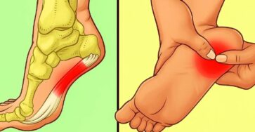7 effective exercises to reduce heel pain and manage plantar fasciitis naturally