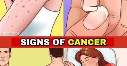 12 Early Warning Signs Your Body May Be Developing Cancer Cells